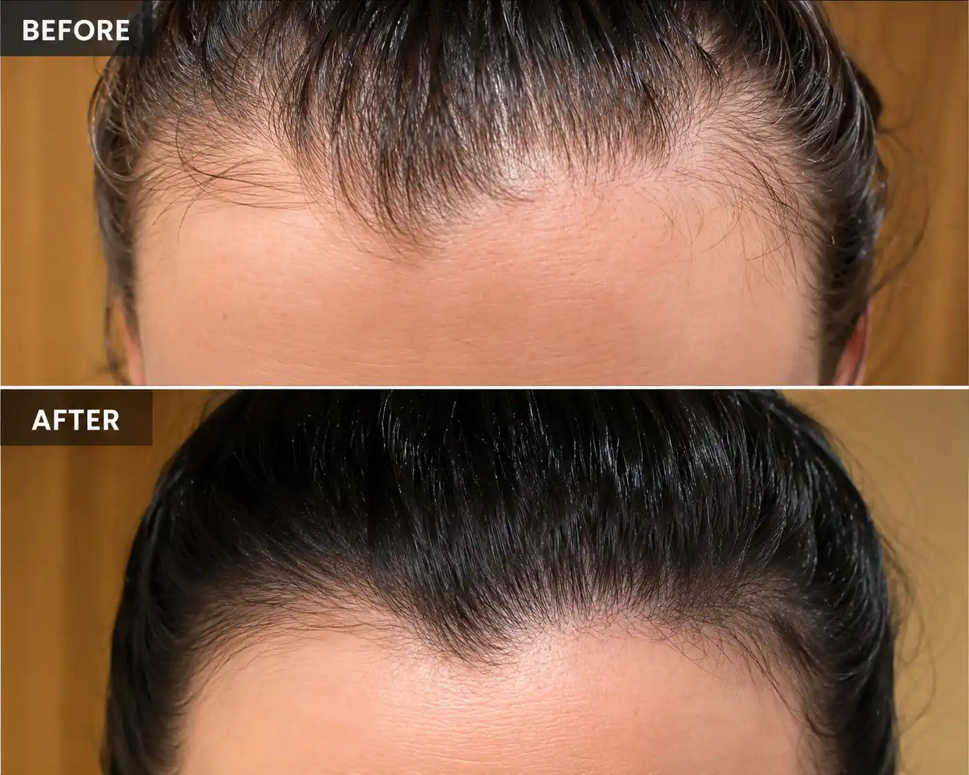 SERAI Follicle Renewal Serum, Korean scalp serum for thinning hair and dry scalp