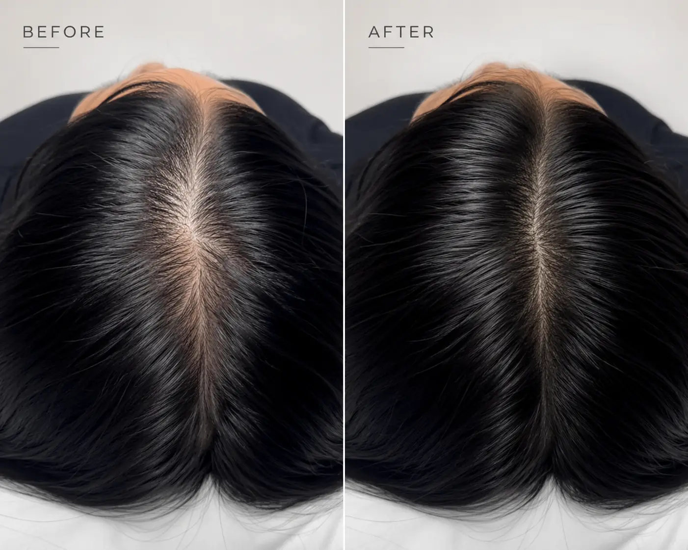SERAI Follicle Renewal Serum, Korean scalp serum for thinning hair and dry scalp