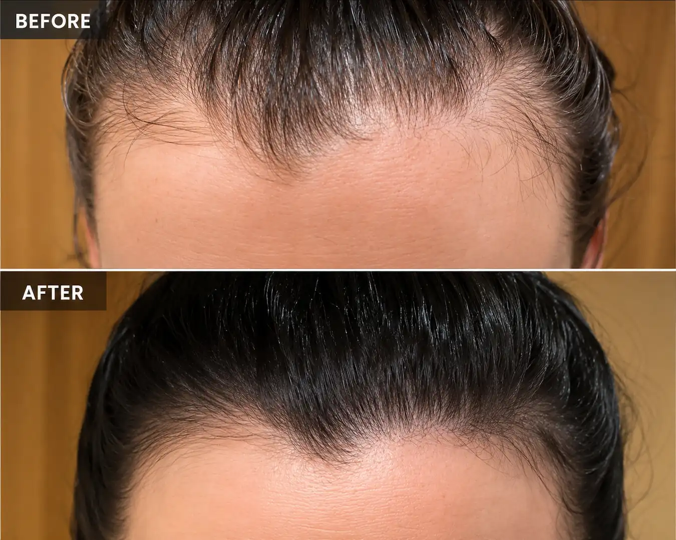 SÉRAI Scalp Density Serum - Image 2