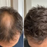 SÉRAI Scalp Density Serum