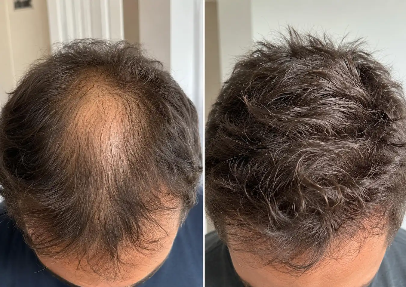 SÉRAI Scalp Density Serum - Image 3