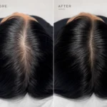 SÉRAI Scalp Density Serum