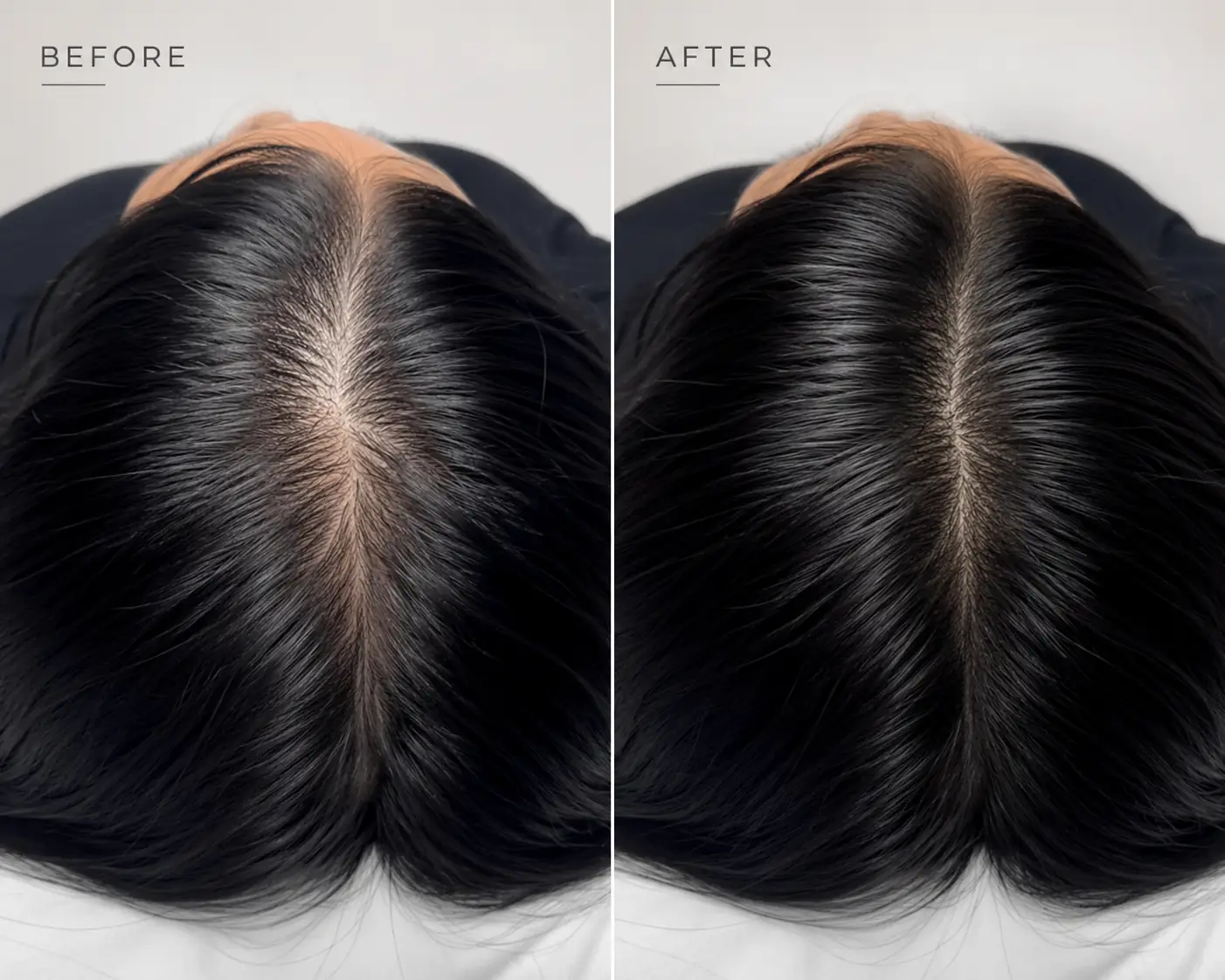 SÉRAI Scalp Density Serum - Image 4